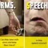 FAST Stroke test advice