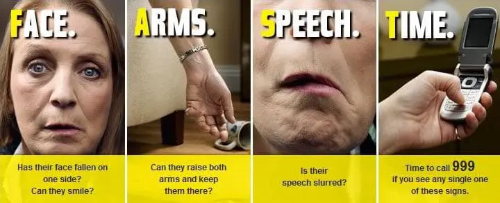 FAST Stroke test advice