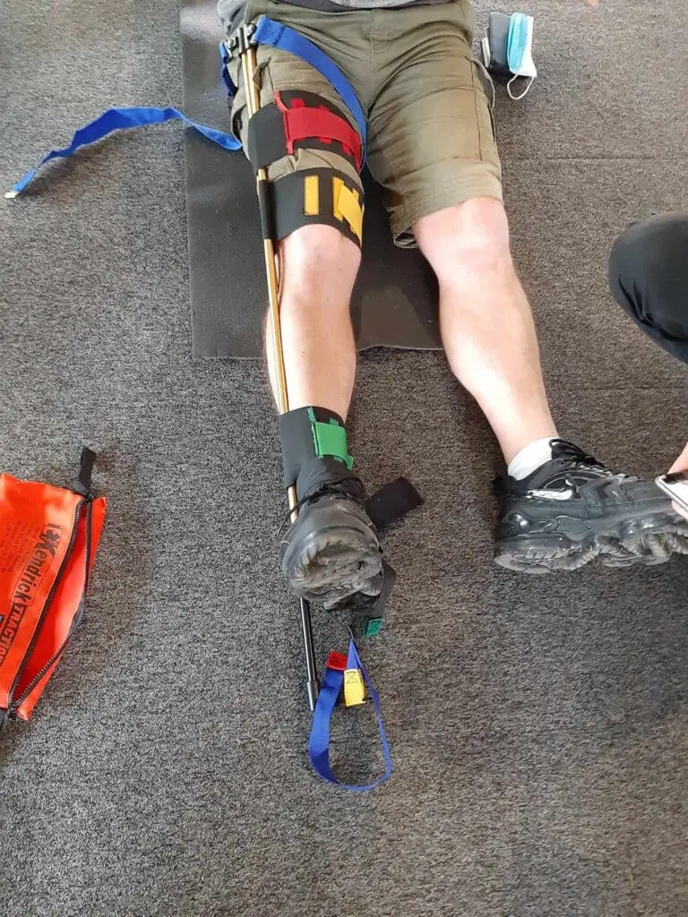 A Kendrick being used to splint a leg