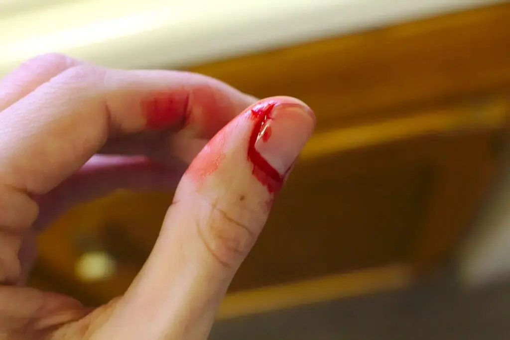 A close up of a hand with bleeding thumb. First aid for gardeners.