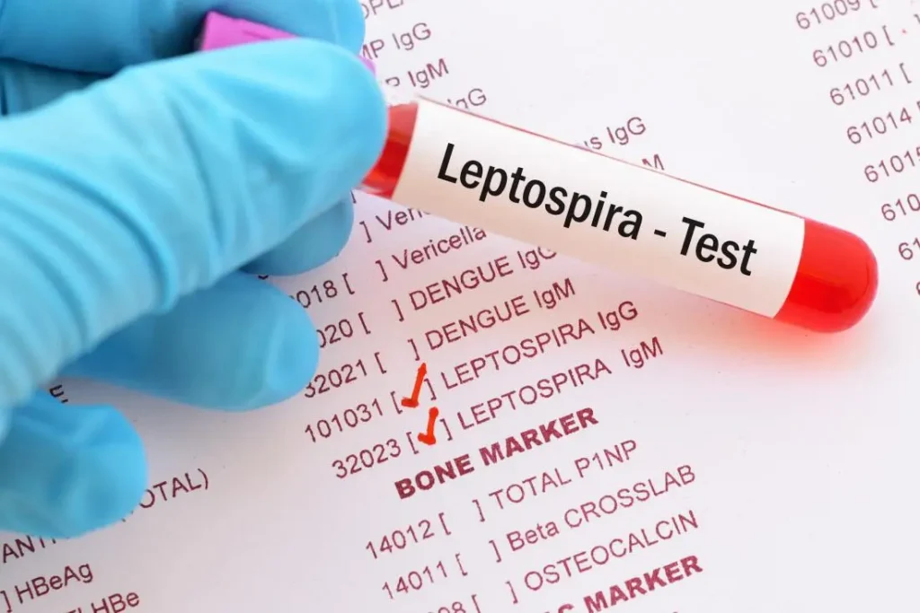 leptospirosis test tube